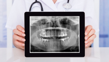 Ortopantomografía / RX Panorámica Dental