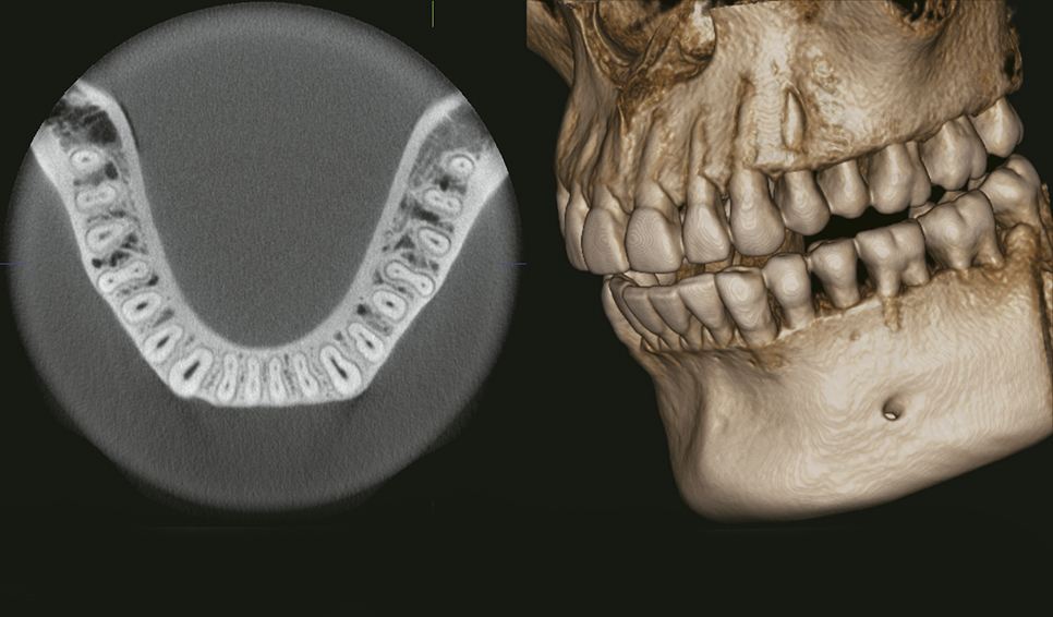 Tac Dental 3D (CBCT)